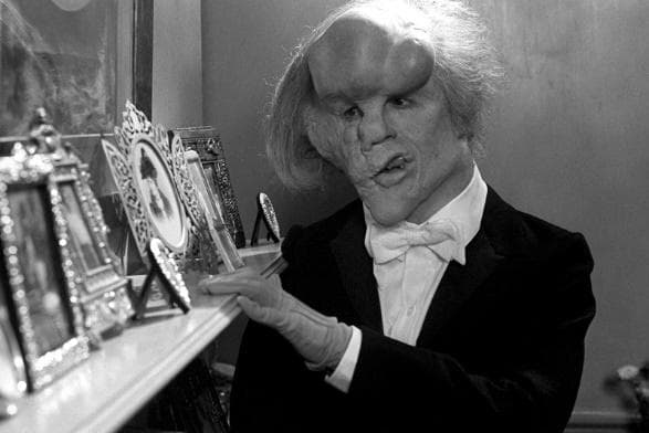 خلاصه کتاب داستان "The Elephant Man" نوشته  Tim Vicary