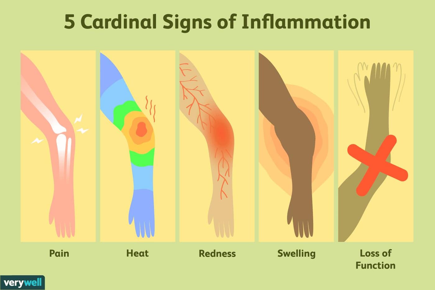 معنی جمله Presence of inflammation چیست؟.jpg