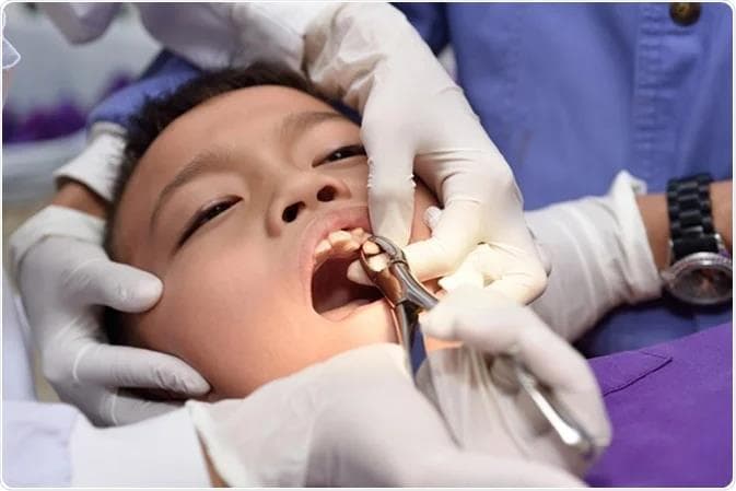 پسری با دهان باز که روی دندان او کارهای پزشکی انچام می‌شود.