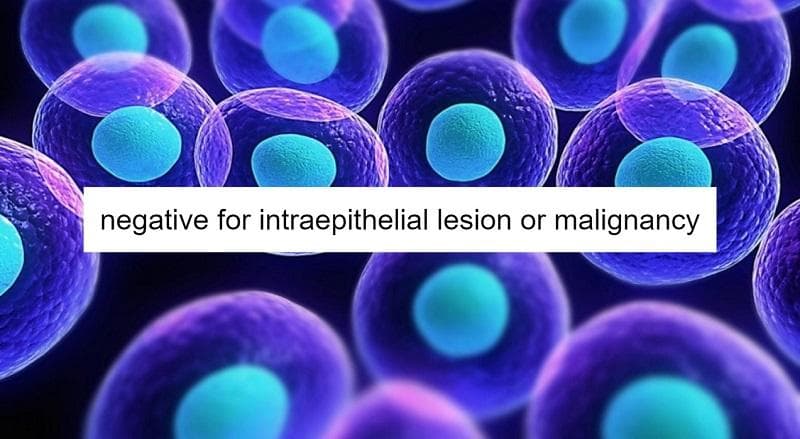 معنی جمله "negative for intraepithelial lesion or malignancy" چیست؟